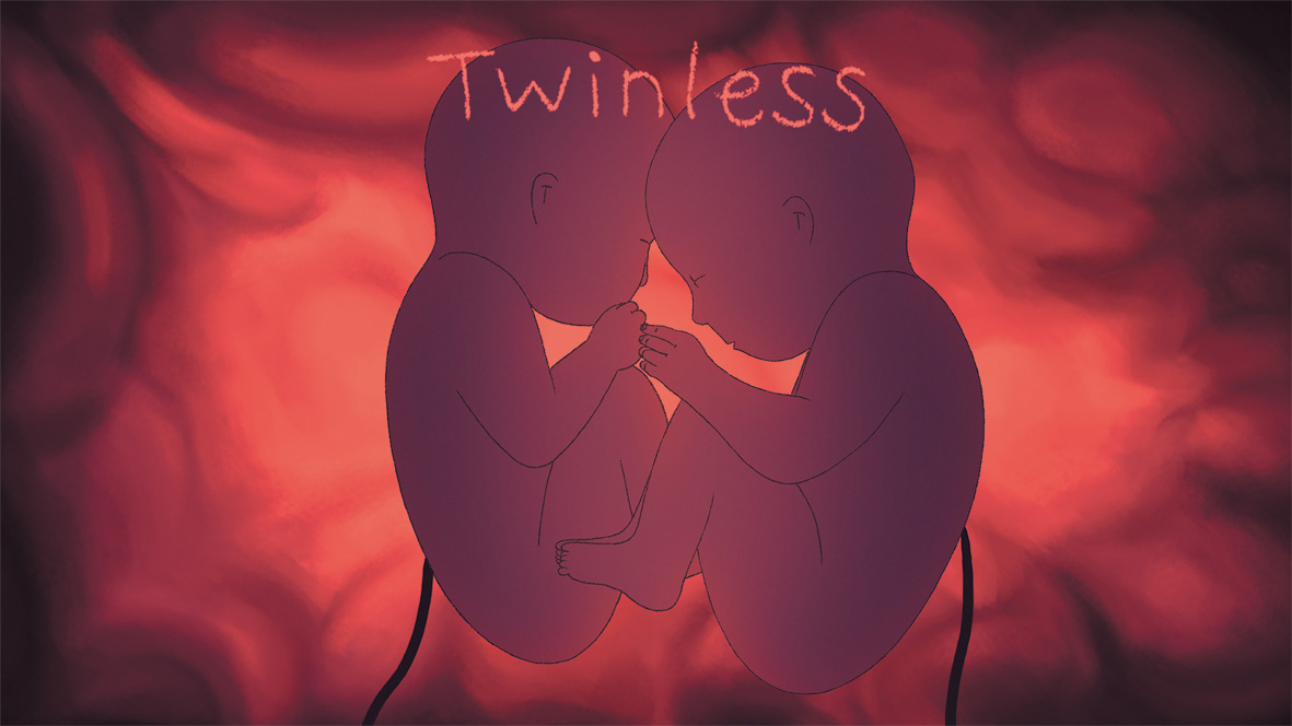 ANI-j33_-Twinless_Frame